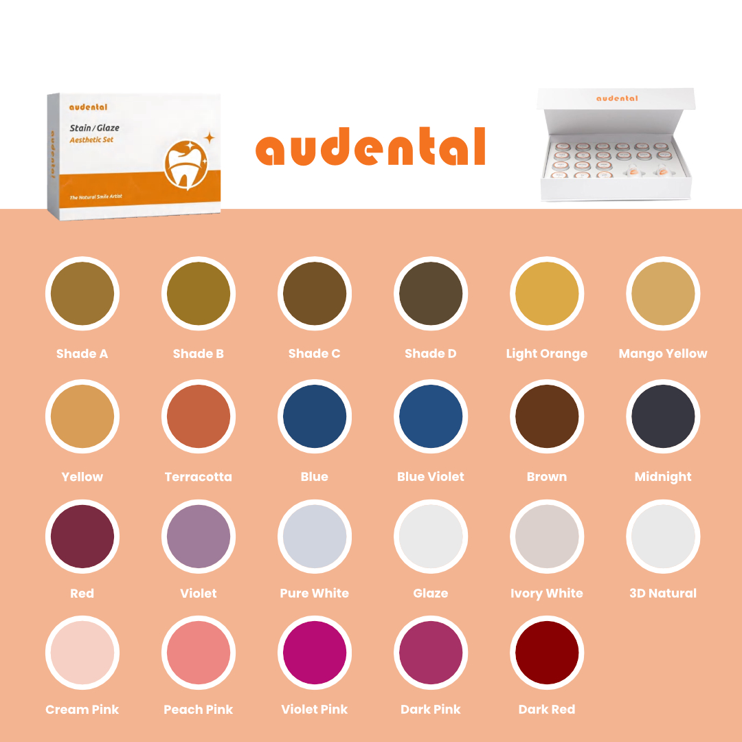 Glaze Color Chart